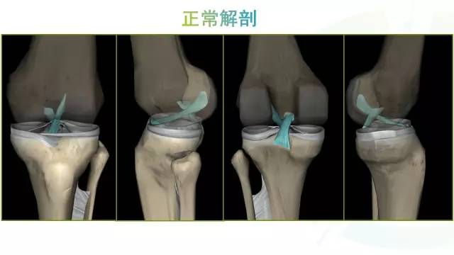 【PPT】膝关节周围韧带解剖及MR表现