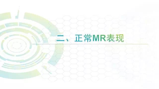 【PPT】膝关节周围韧带解剖及MR表现