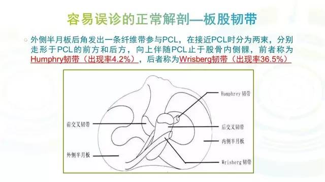 【PPT】膝关节周围韧带解剖及MR表现