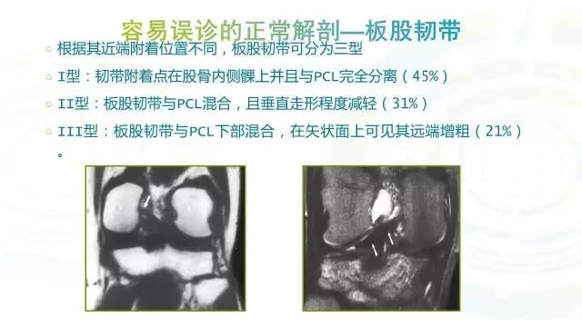【PPT】膝关节周围韧带解剖及MR表现