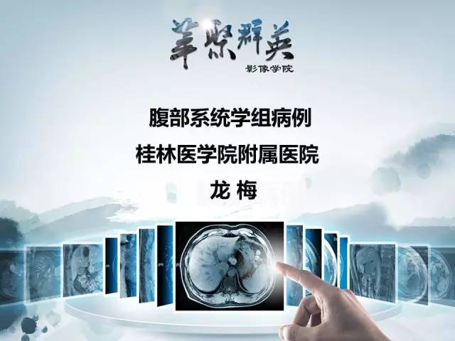【病例】肝胆管腺瘤1例CT及MR影像表现