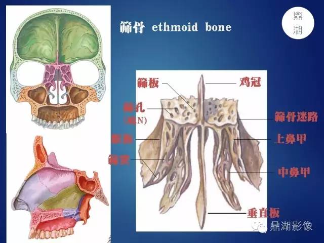 颅骨彩图解剖