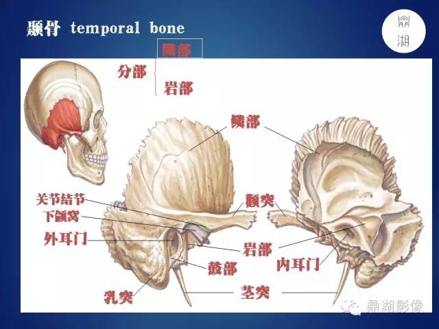 颅骨彩图解剖