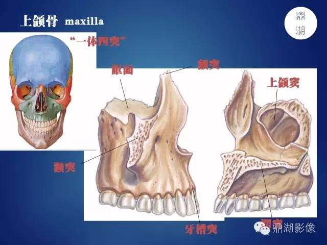 颅骨彩图解剖