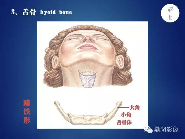 颅骨彩图解剖