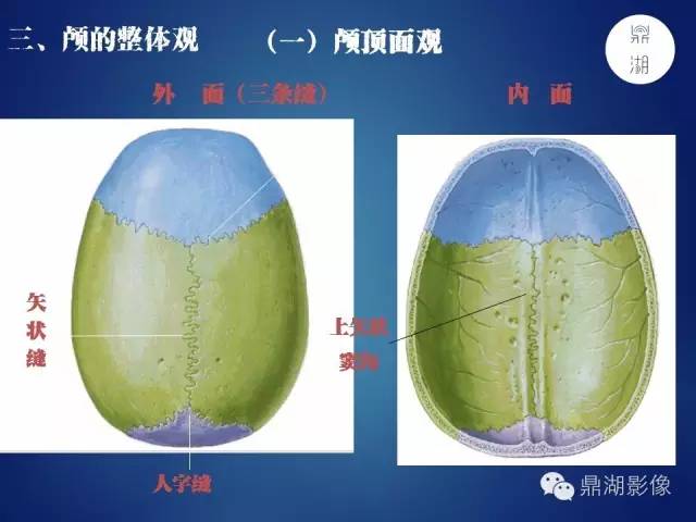 颅骨彩图解剖