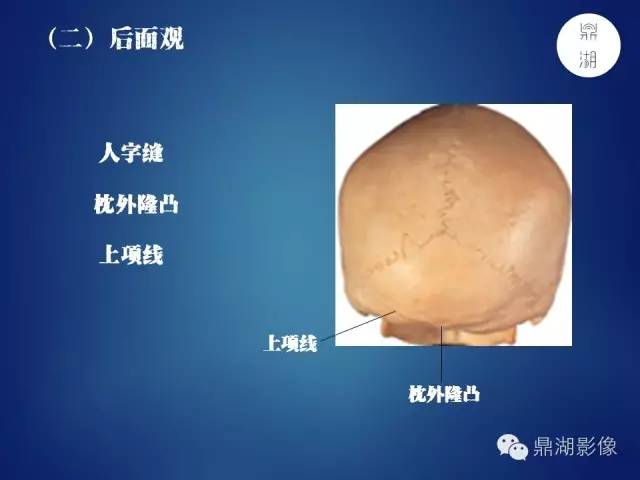 颅骨彩图解剖