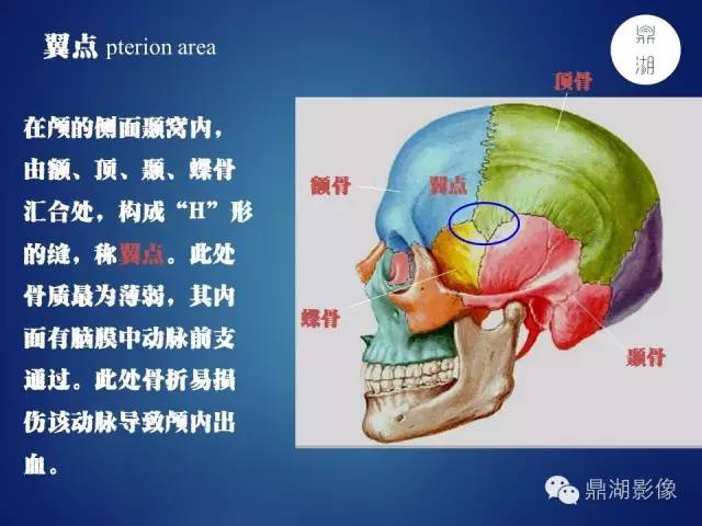 颅骨彩图解剖