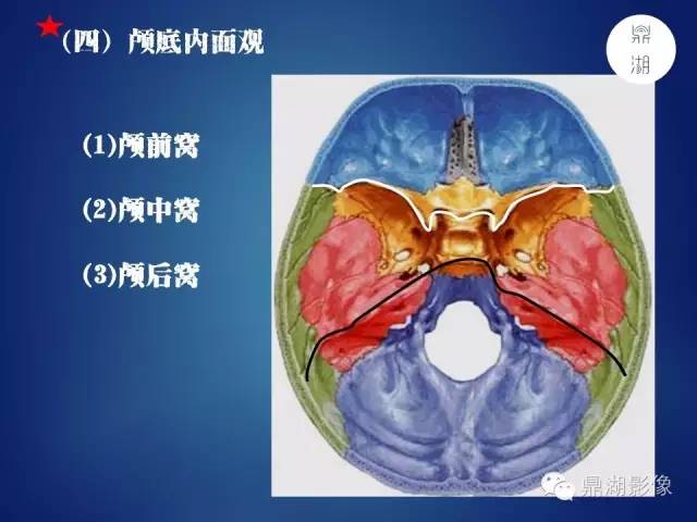 颅骨彩图解剖