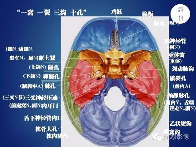颅骨彩图解剖