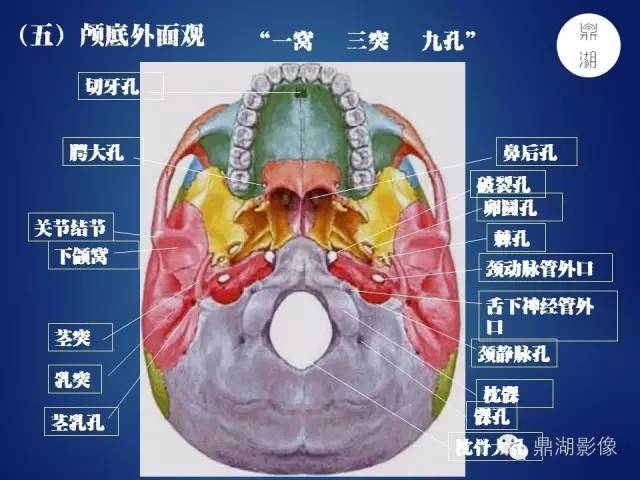 颅骨彩图解剖