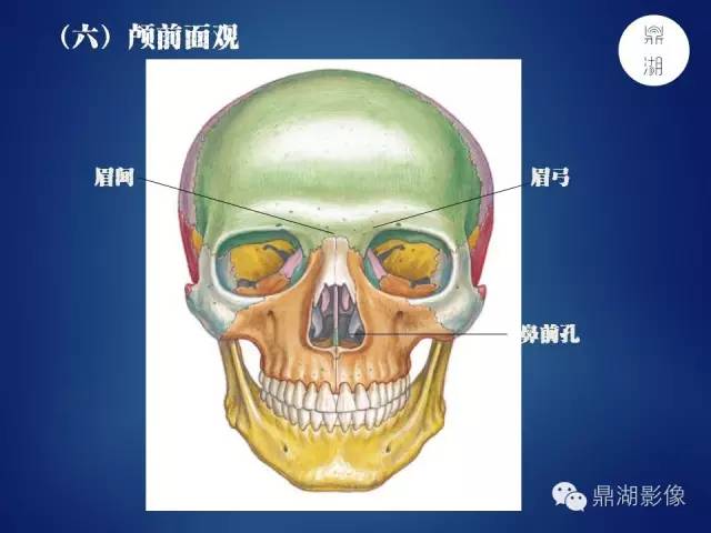 颅骨彩图解剖
