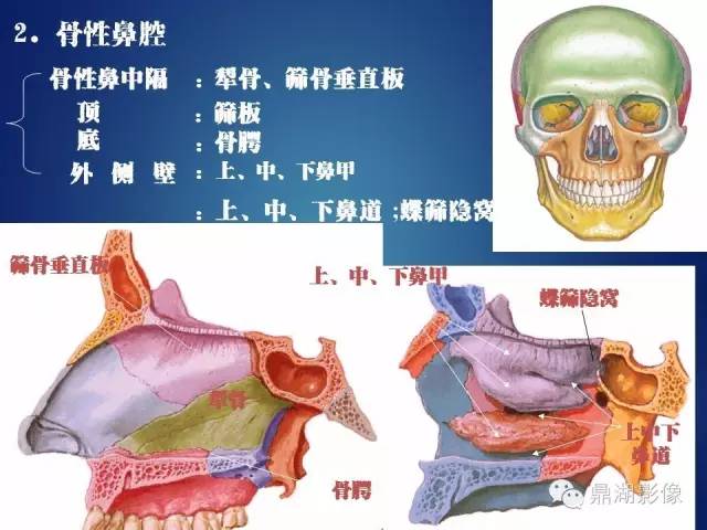 颅骨彩图解剖