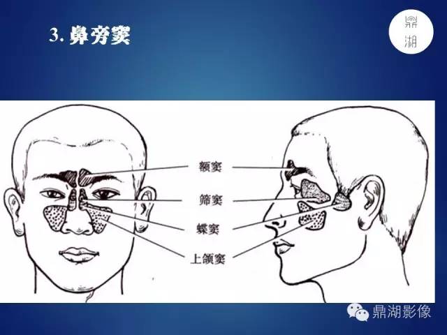 颅骨彩图解剖