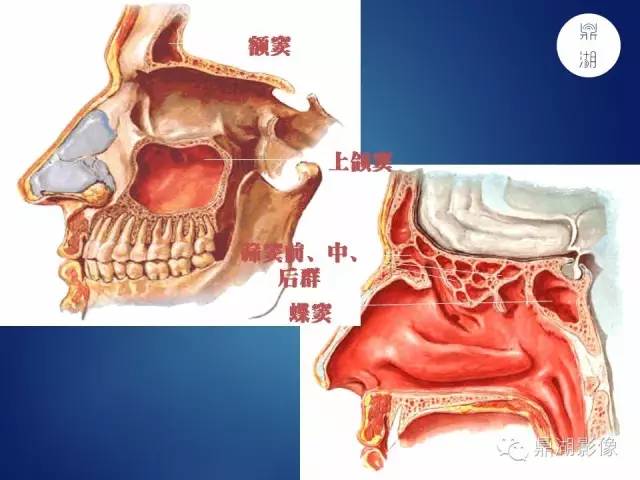 颅骨彩图解剖
