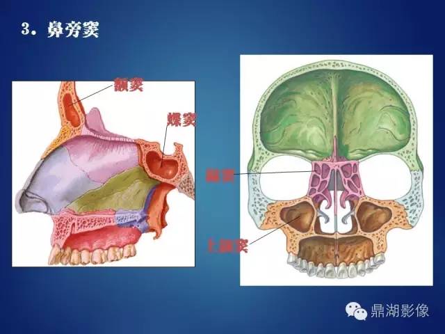 颅骨彩图解剖