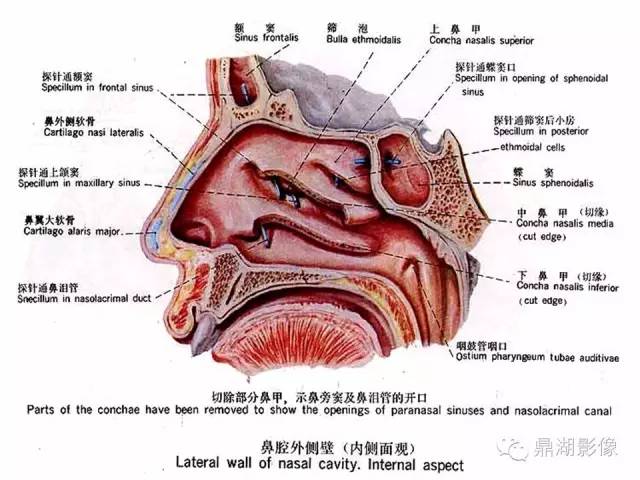 颅骨彩图解剖