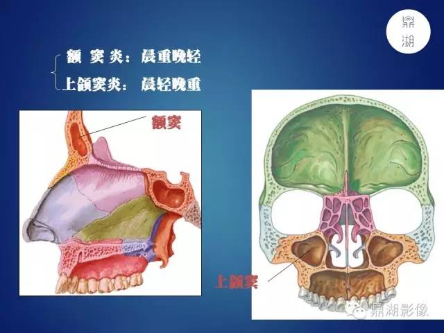 颅骨彩图解剖