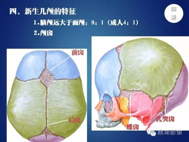 颅骨彩图解剖