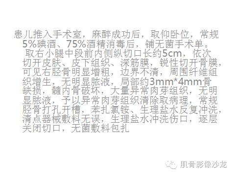 【病例】胫骨嗜酸性肉芽肿1例X线影像讨论