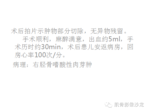 【病例】胫骨嗜酸性肉芽肿1例X线影像讨论