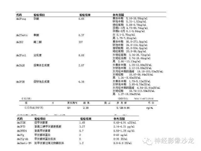 【病例】垂体脓肿一例MR影像讨论 【病例】垂体脓肿一例MR影像讨论