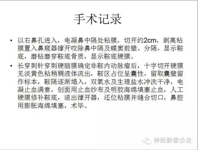 【病例】垂体脓肿一例MR影像讨论 【病例】垂体脓肿一例MR影像讨论
