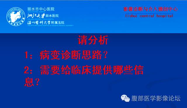 【病例】右肾乳头状细胞癌1例CT影像表现 【病例】右肾乳头状细胞癌1例CT影像表现