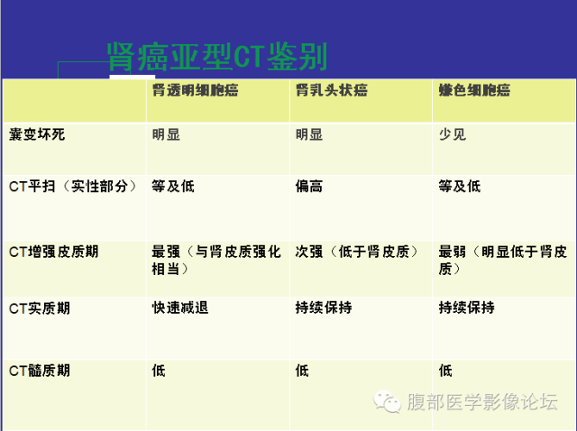 【病例】右肾乳头状细胞癌1例CT影像表现 【病例】右肾乳头状细胞癌1例CT影像表现