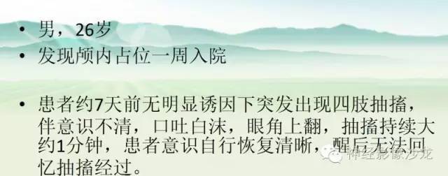 【病例】右侧顶枕叶少突胶质细胞瘤1例MR影像讨论