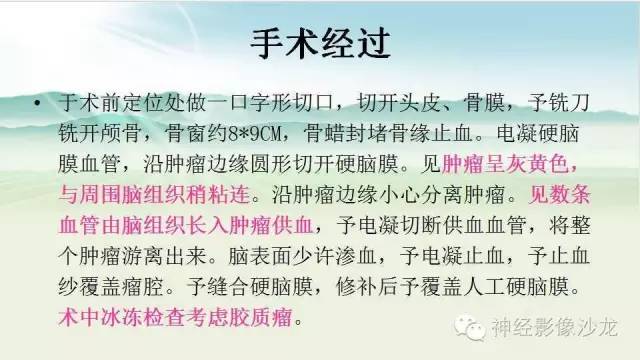 【病例】右侧顶枕叶少突胶质细胞瘤1例MR影像讨论 【病例】右侧顶枕叶少突胶质细胞瘤1例MR影像讨论