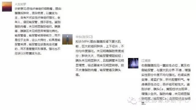 【病例】腹膜后恶性纤维组织细胞瘤1例CT影像表现