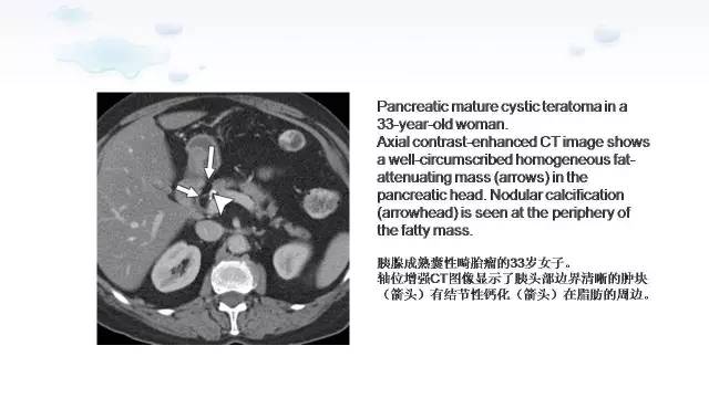 【PPT】含脂肪的腹膜后病变：影像学特点、定位及鉴别诊断