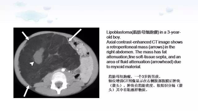 【PPT】含脂肪的腹膜后病变：影像学特点、定位及鉴别诊断