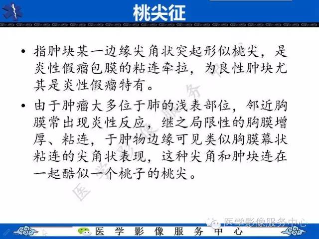 【影像征象】桃尖征