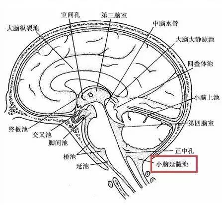 一起学习长在小脑延髓池的七个肿瘤