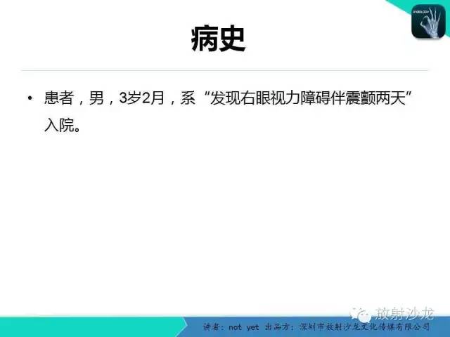 【病例】盆腔未成熟畸胎瘤1例CT影像表现