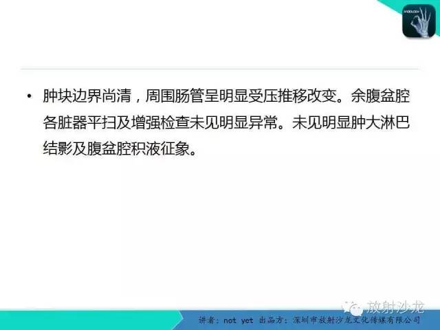 【病例】盆腔未成熟畸胎瘤1例CT影像表现