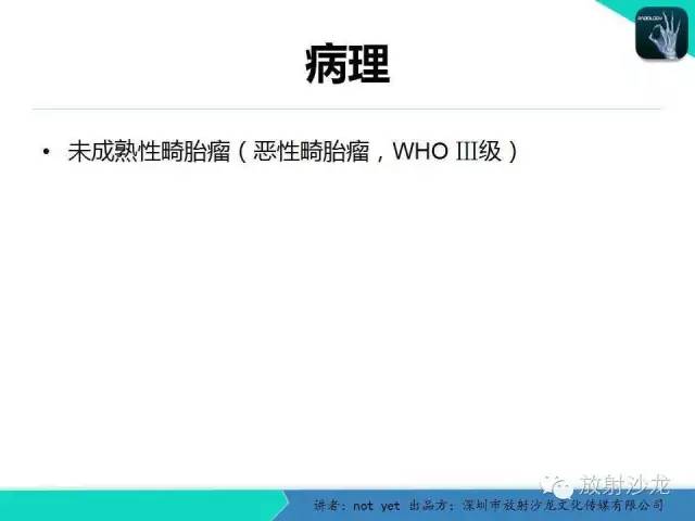 【病例】盆腔未成熟畸胎瘤1例CT影像表现