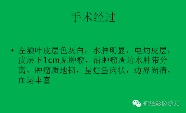 【病例】脑胶质瘤两例MR影像表现