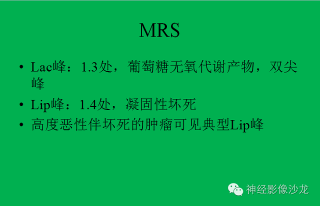 【病例】脑胶质瘤两例MR影像表现
