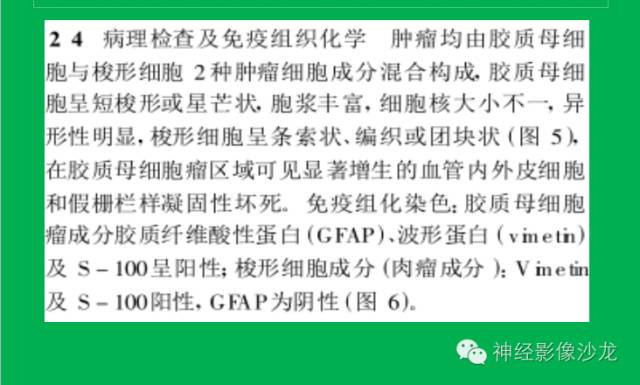 【病例】脑胶质瘤两例MR影像表现