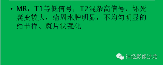 【病例】脑胶质瘤两例MR影像表现