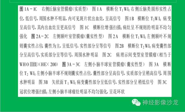 【病例】脑胶质瘤两例MR影像表现
