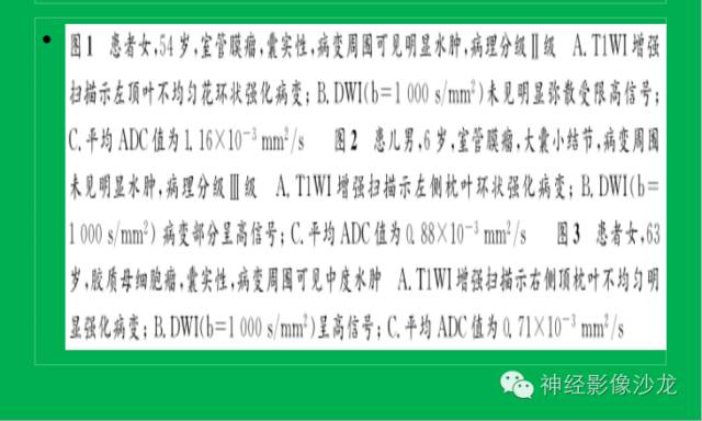 【病例】脑胶质瘤两例MR影像表现