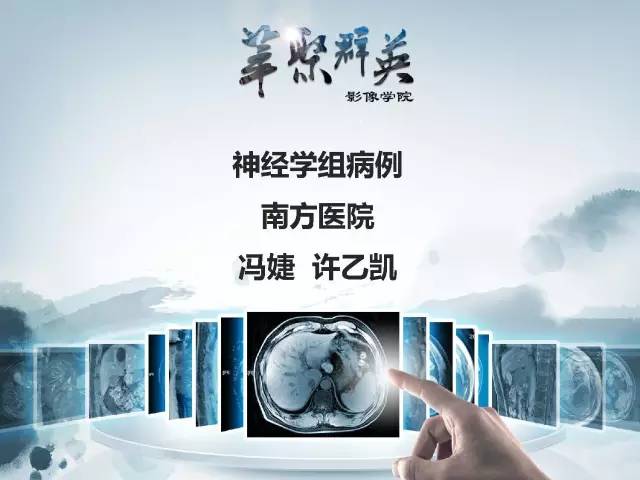 【病例】颅内好大一团钙化——右额叶室管膜瘤1例CT及MR影像表现