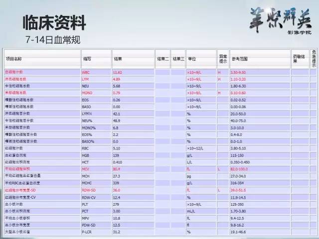 【病例】颅内好大一团钙化——右额叶室管膜瘤1例CT及MR影像表现