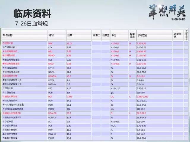 【病例】颅内好大一团钙化——右额叶室管膜瘤1例CT及MR影像表现