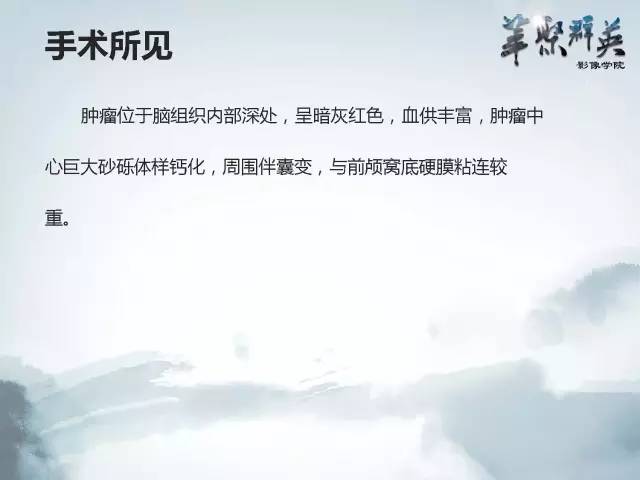 【病例】颅内好大一团钙化——右额叶室管膜瘤1例CT及MR影像表现