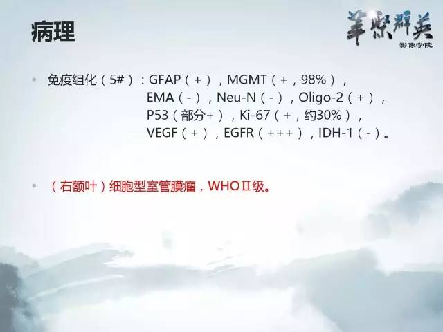 【病例】颅内好大一团钙化——右额叶室管膜瘤1例CT及MR影像表现